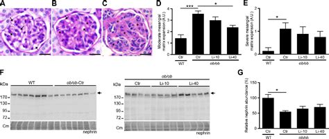 Figure From Lithium Reduces Blood Glucose Levels But Aggravates