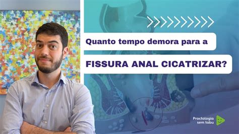 Quanto Tempo Demora Para Fissura Cicatrizar Quanto Tempo Gasta Para