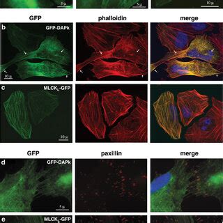 GFPDAPk Localizes To Actin Stress Fibers A HeLa Cells Expressing