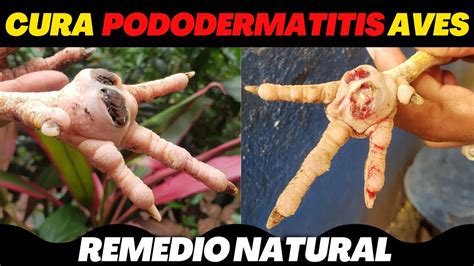 Como Curar La Pododermatitis Plantar En Aves Gallinas Gallos Y Pollos