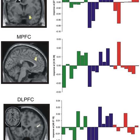 Results Of The Functional Magnetic Resonance Imaging Fmri Analysis A Download Scientific