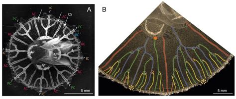 A Picture Of A Juvenile Jellyfish Showing The Structure Of The