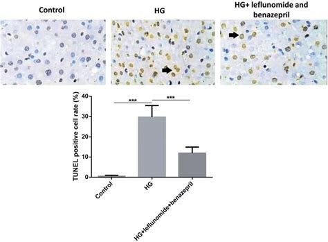 TUNEL Assay Of Different Groups Of RMCs Treatment Of High Glucose