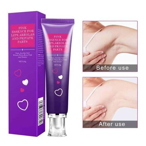 Private Part Whitening Bikini Singit Inguinal Knee Armpit Underarm Neck Butt Whitening Body