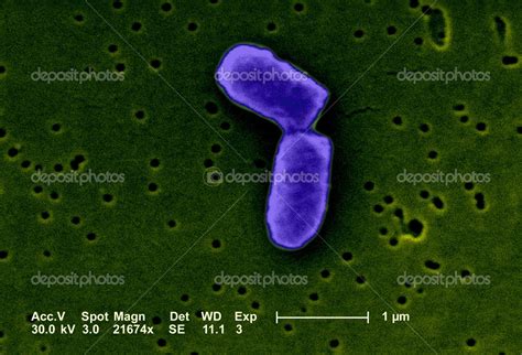 Escherichia Coli Under The Microscope Stock Photo By Imagepointfr