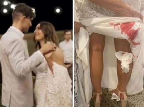 Marriage Expert Advice On Dating Weddings Sex News Au Australias Leading News Site