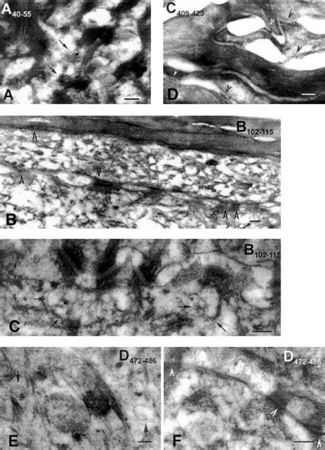 Immunoelectron Microscopy Analysis Of Human Skin With Affinity Purified