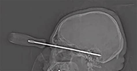 Нейро | Пикабу