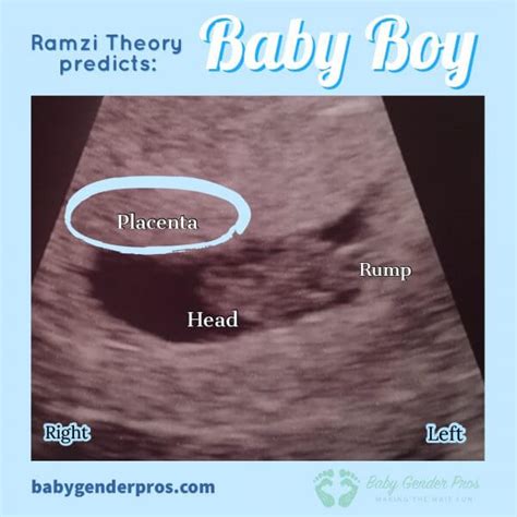 Baby Gender Pros How To Know The Gender Of Your Baby Early