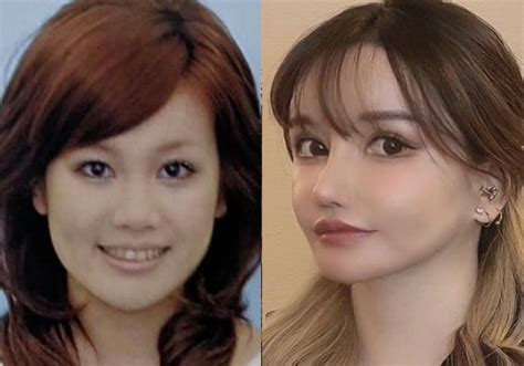 【整形美女】遺書を書いて臨んだ“フル整形4周ラストスパート”20年以上顔面を整形し続けた女性「もうこれが限界だと納得した」｜eltha（エルザ）