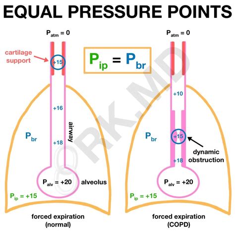 Equal Pressure Point In Lung Physiology | RK.MD