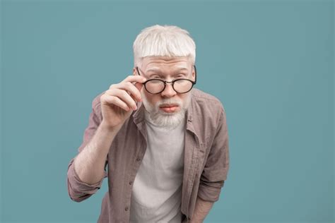 Ocular Albinism: What It Is & How It Affects Vision | MyVision.org