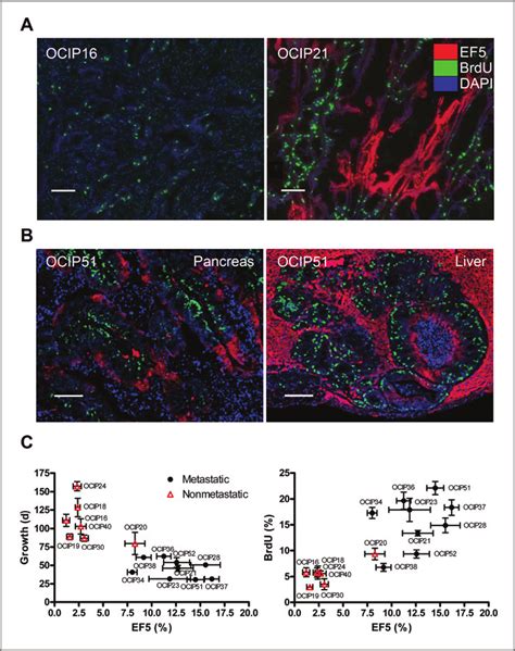 Hypoxia And Brdurd Labeling A Dual Immunofluorescence Staining For