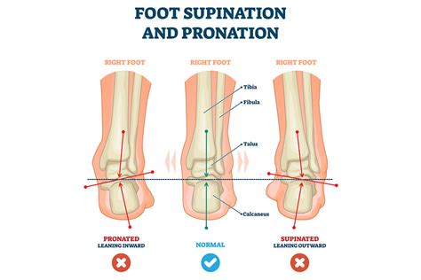 The Differences Between Pronation And Supination Of The Ankles Ideastep