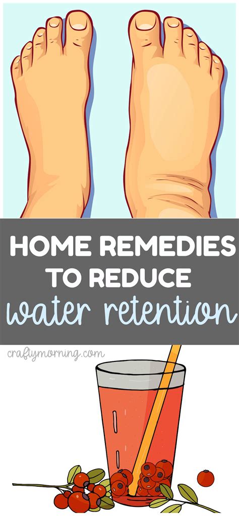 Water retention remedies – Artofit