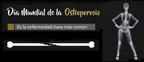 D A Mundial De La Osteoporosis De Octubre Conciencia Femenina