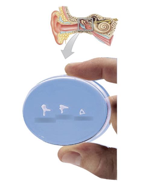 the auditory ossicles -page 8 Diagram | Quizlet