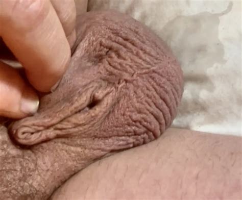 Micro Cock Tiny Penis Pictures Nude Pics XHamster