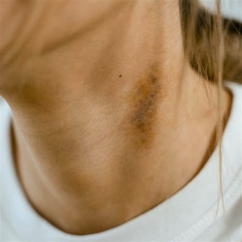 Causes Of Sex Addiction Thrive Beyond Truama