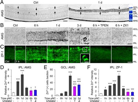 Mobile Zinc Increases Rapidly In The Retina After Optic Nerve Injury