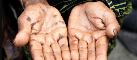 Arsenic Contamination Of Food And Water Is A Global Public Health