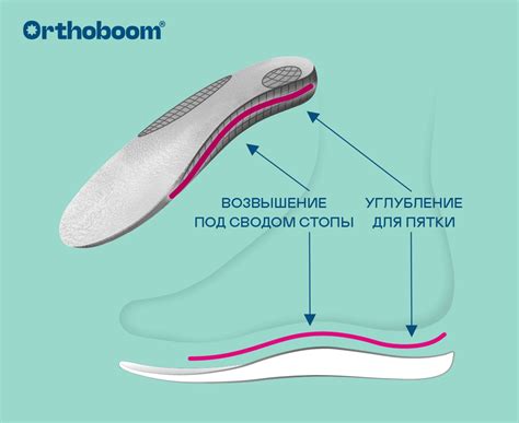 Что такое супинатор в обуви — статьи интернет-магазина Orthoboom