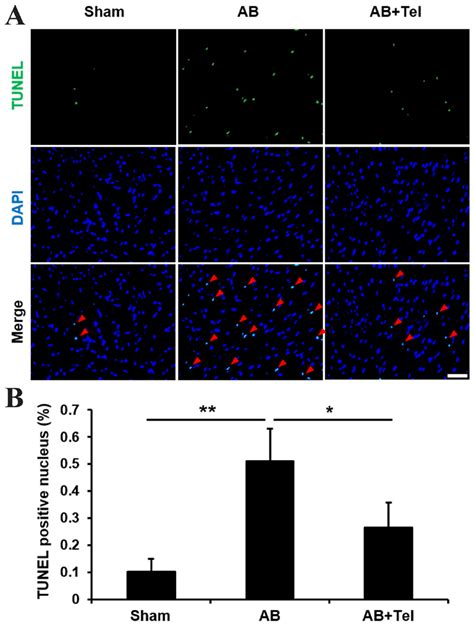 Detection Of Apoptosis In Cardiac Myocytes Treated With Tel By Tunel