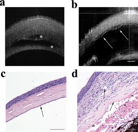 High Resolution Cross Section Octa Image Of Cornea A Corneal Edema