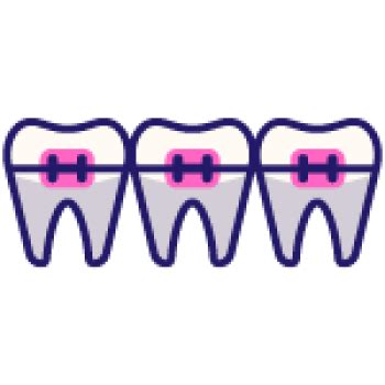 Hot Pink Braces 10 Pros 3 Cons Ultimate Year Guide