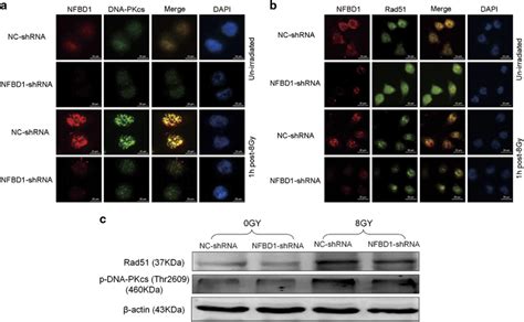 Nfbd Regulates Dna Pkcs And Rad Foci Formation A And B Inhibition