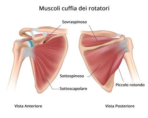 Tendinopatia Della Cuffia Dei Rotatori Fisiomed