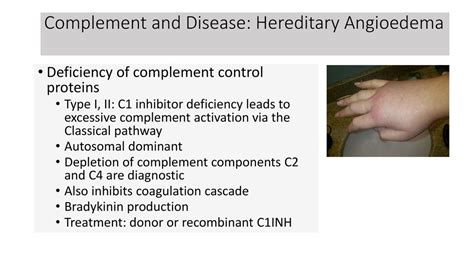 Complement And Complement Disorders Ppt Download