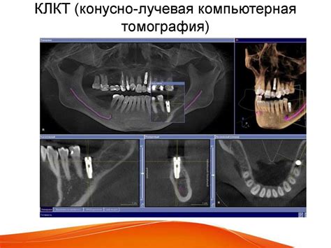 Лучевая диагностика в стоматологии - презентация онлайн