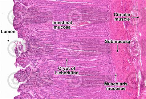 Small Intestine Histology Labeled Histology Slides Human Anatomy And