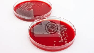 Escherichia Coli Bacteria On Columbia Blood Agar Posters For The Wall