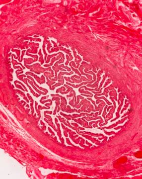 Endo Repro Exam Histology Genital System Female Ii Fallopian Tubes Uterus Vagina Mammary