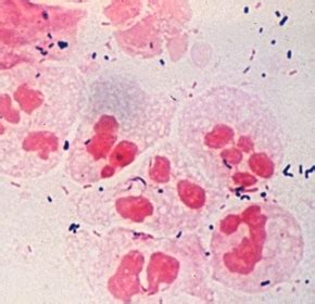 Sex Ασθένειες Γυμνάσιο Αμυνταίου σεξουαλική διαπαιδαγώ