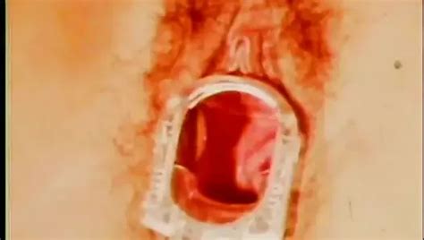 Klinik Der Perversionen Free Retro Porn Video 8c XHamster