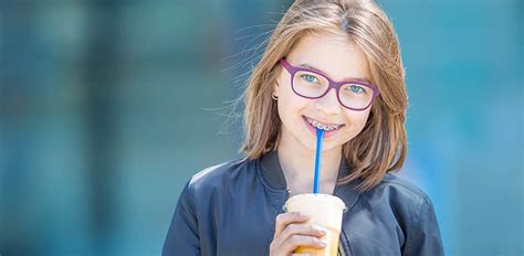 What Types Of Food Can I Eat With Braces?