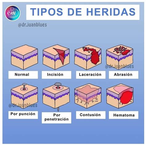 Tipos De Heridas Medicina De Urgencias Tipos De Heridas Cosas De