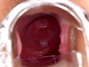 Cervix Page 9 Porn Tube Videos At YouJizz