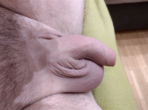 Extreme Cock Banding 10 Nude Pics XHamster