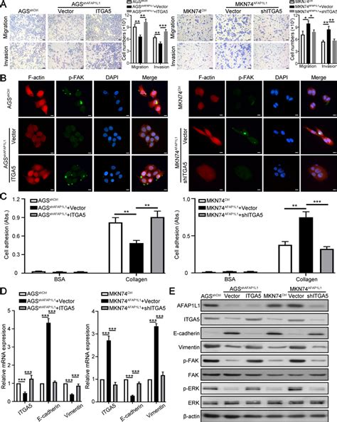 ITGA5 Is Necessary For AFAP1L1 Mediated GC Migration Invasion And EMT