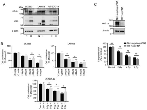 Hypoxia Induces Radioresistance Epithelialmesenchymal Transition