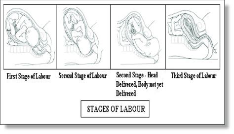 Stages Of Labour Download Scientific Diagram