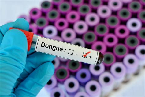 Munic Pio De It Conta Casos Confirmados Para Dengue Lance