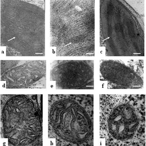 Transmission Electron Microscopic Tem Observations Of Organelle