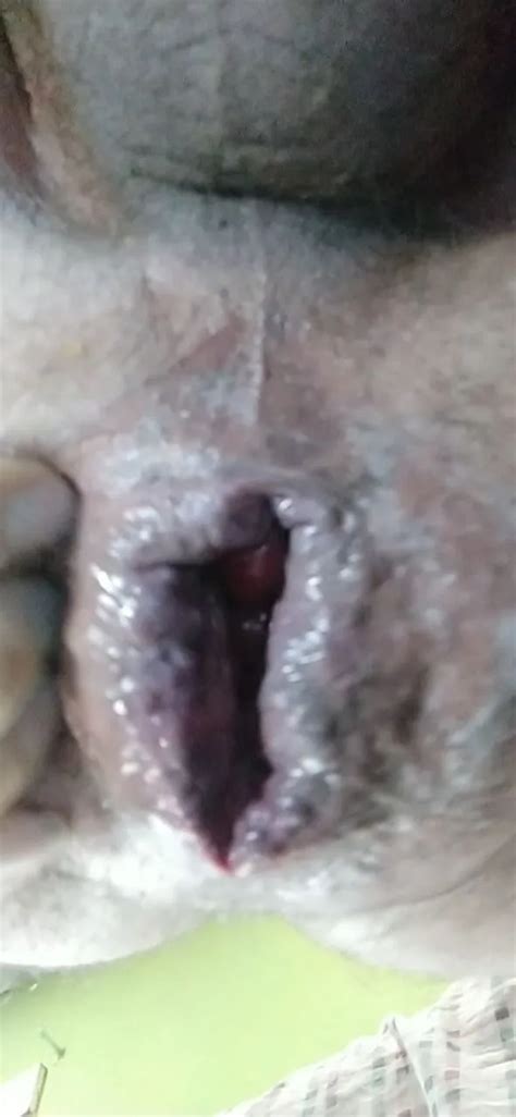 My Ass Pics Xhamster