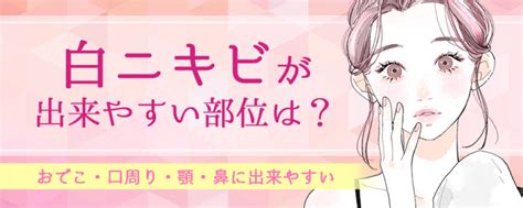 白ニキビは潰すと早く治る？ニキビの原因や一晩で治す方法はあるのか解説します