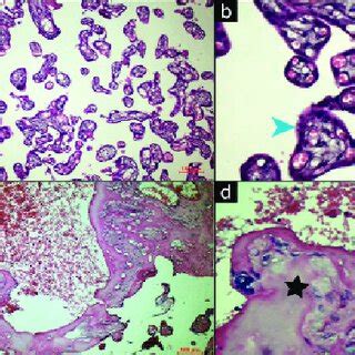 Hematoxylin Eosin Staining Of Placental Sections A B Histologically